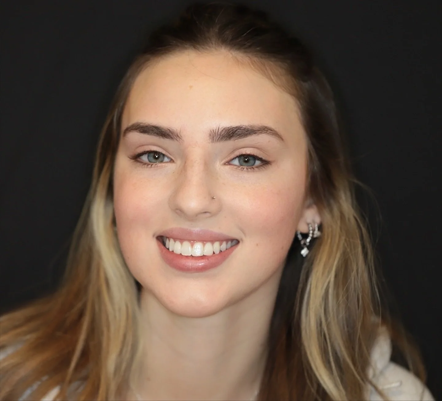 Porcelain magic literally 💕✨ #boston #bostondentist #porcelainveneers #fyp #mielveneers