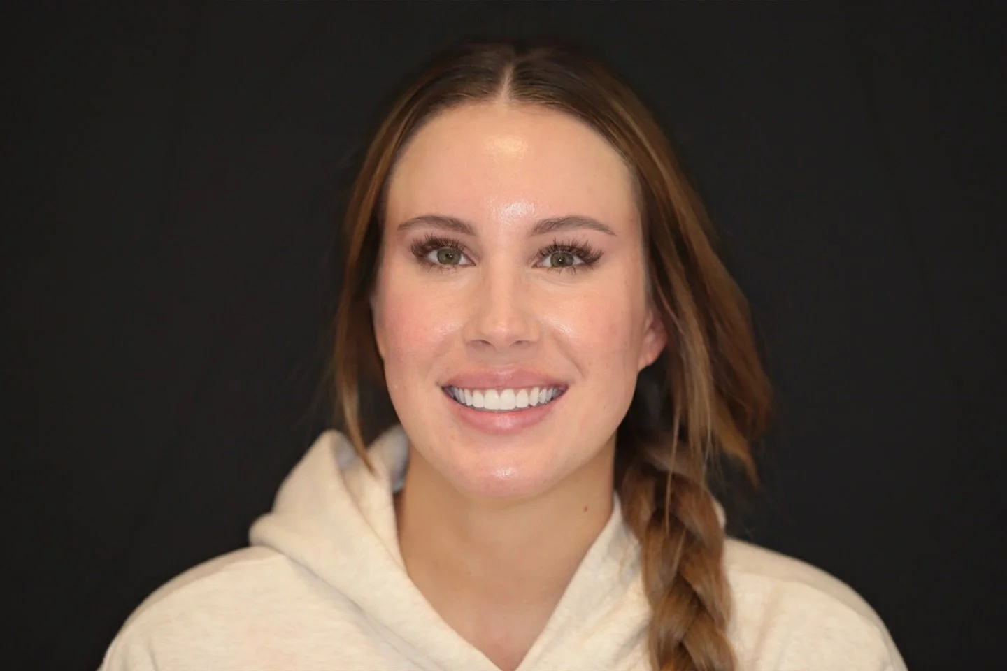 Sculpted Composite by Dr T ✨🥂 #compositebonding #boston #bostondentist #peabodydentist #fyp