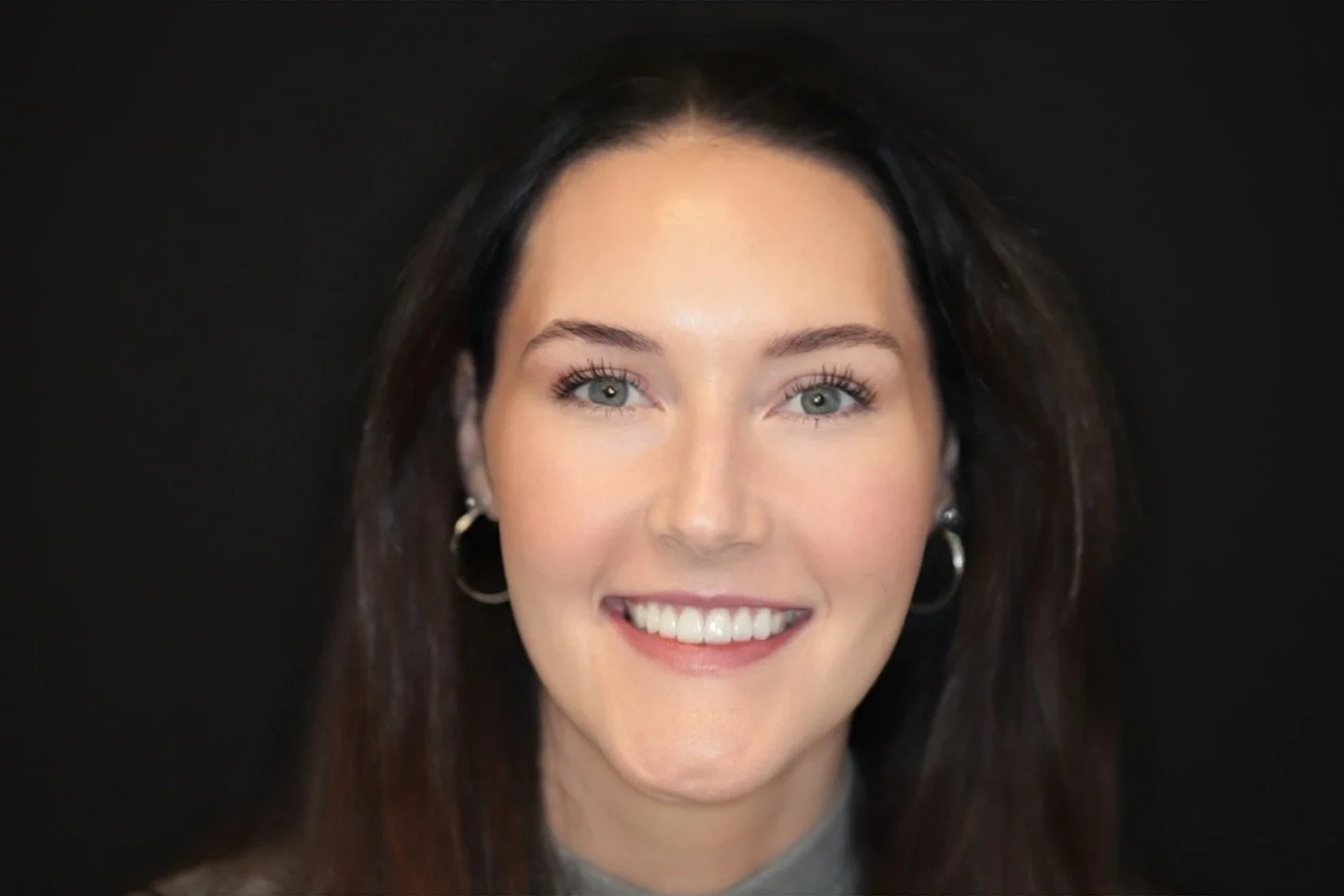 Our first bride of 2026&hellip; and the beginning of a beautiful season ahead. ✨

She chose Mi&eacute;l Sculpted&trade; Minimal-Prep Veneers for a refined, natural, camera-ready smile designed to glow from &ldquo;yes&rdquo; to &ldquo;I do.&rdquo;

Br