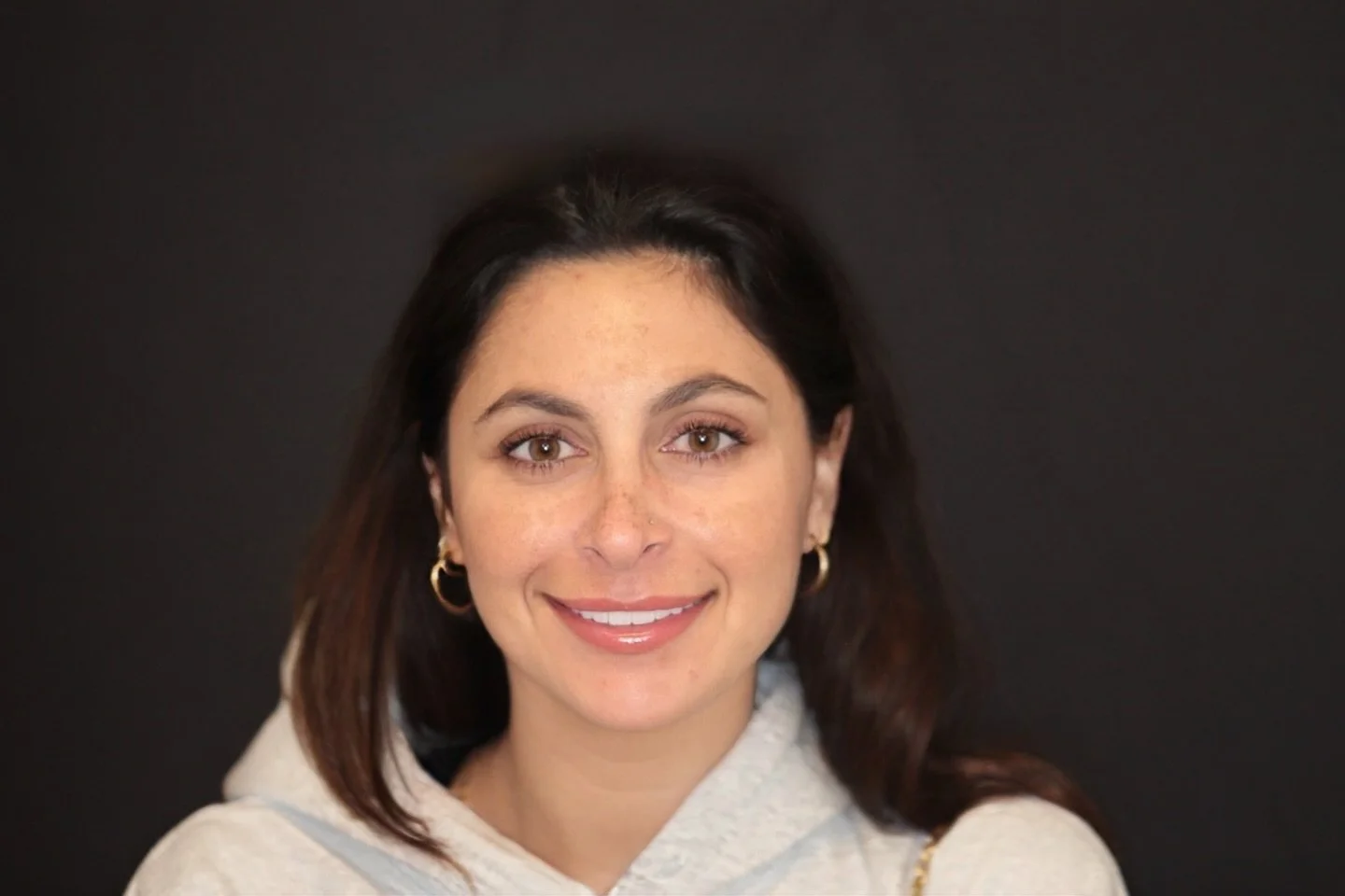 10 Hybrid No-Prep Veneers 🤍
A natural, refined smile transformation &mdash; without the bulky, fake look.

✨ 10 Teeth
✨ Hybrid No-Prep Veneers
✨ Completed in Just 3 Visits

We are currently offering 3 complimentary Smile Trials for patients consider