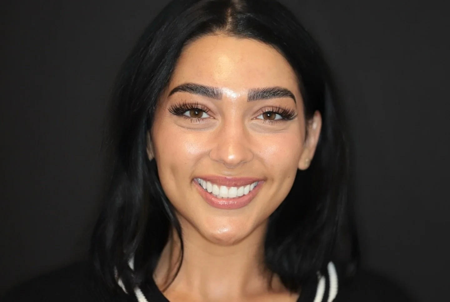 The Finals &bull; Temporaries &bull; The Before Mi&eacute;l Porcelain Veneers #bostondentist #porcelainveneers #compositeveneers