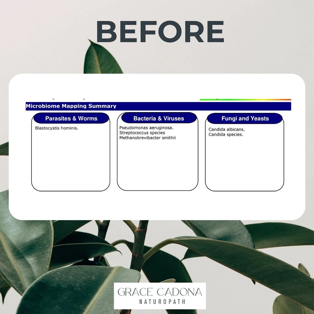 When they say you can&rsquo;t change your gut microbiome!🤭✔️🙌🤗
Working with this patient has been such an incredible ride. Once suffering from anxiety, chronic gut issues, frequent colds/flu, virus&rsquo;, recurrent thrush flare ups and low libido