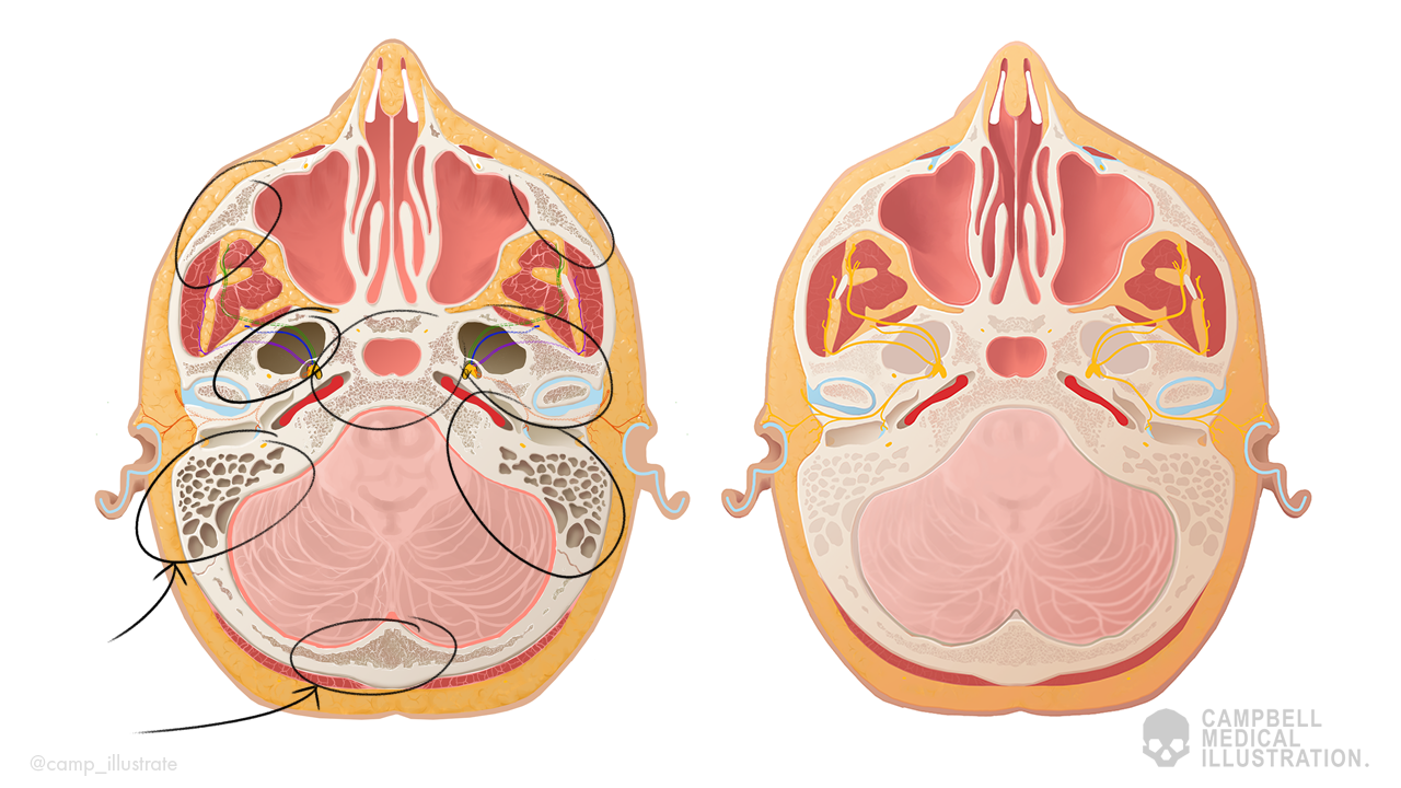 Campbell+Medical+Illustration+Head+cross+section.png
