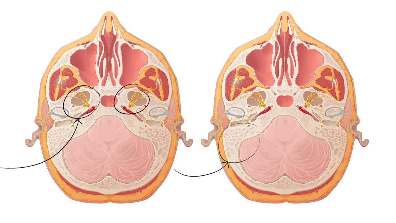 Campbell+Medical+Illustration+Head+cross+section+digital.png