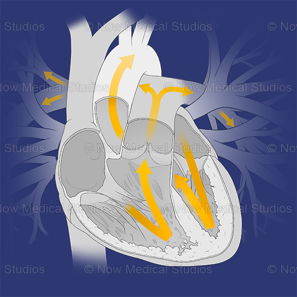 Now_Medical_Studios_Heart-Cross-Section-Systole_dark_blue_background.png