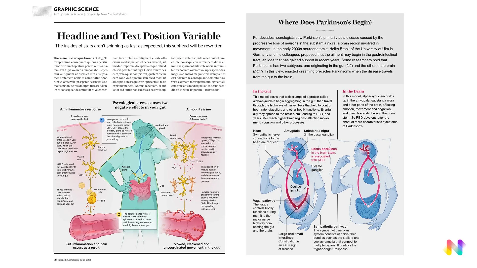 Now Medical Studios Medical Illustration infographic illustrations for Scientific american. brain gut axis. parkinsons disease