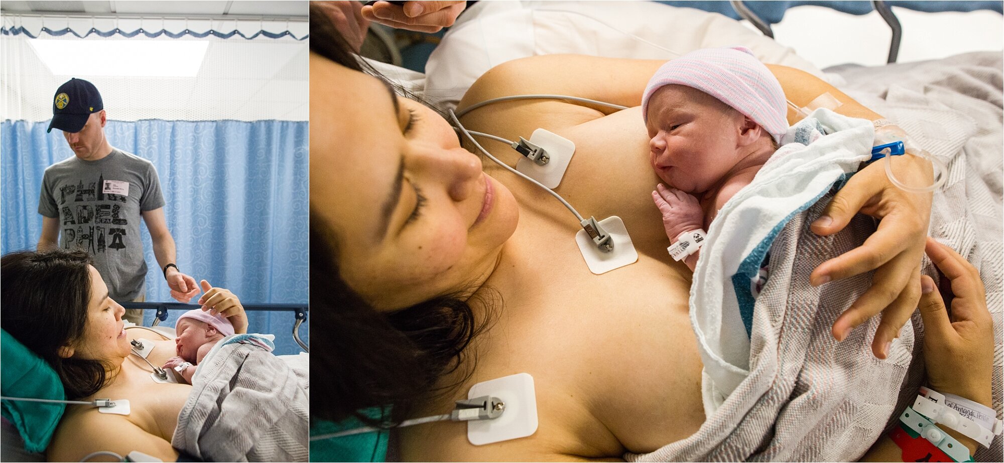 Mother and father in recovery after c-section, new baby rests skin to skin with mom, Philadelphia Birth Photographer
