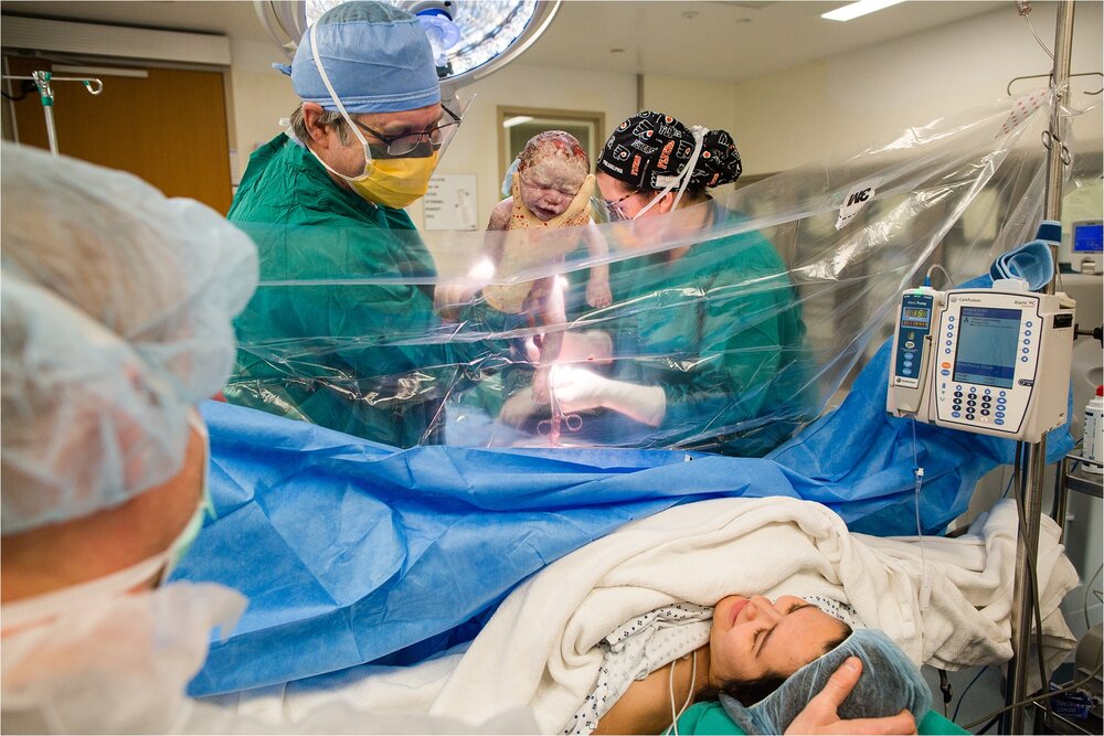 Obstetrician holds newborn baby over surgical drape durcing c-section to show parents, Philadelphia birth photographer