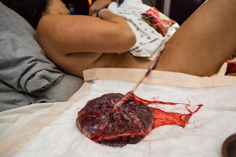 Beautiful photo of placenta on bed next to mom still attached to baby by umbilical cord, Philadelphia Birth Photographer