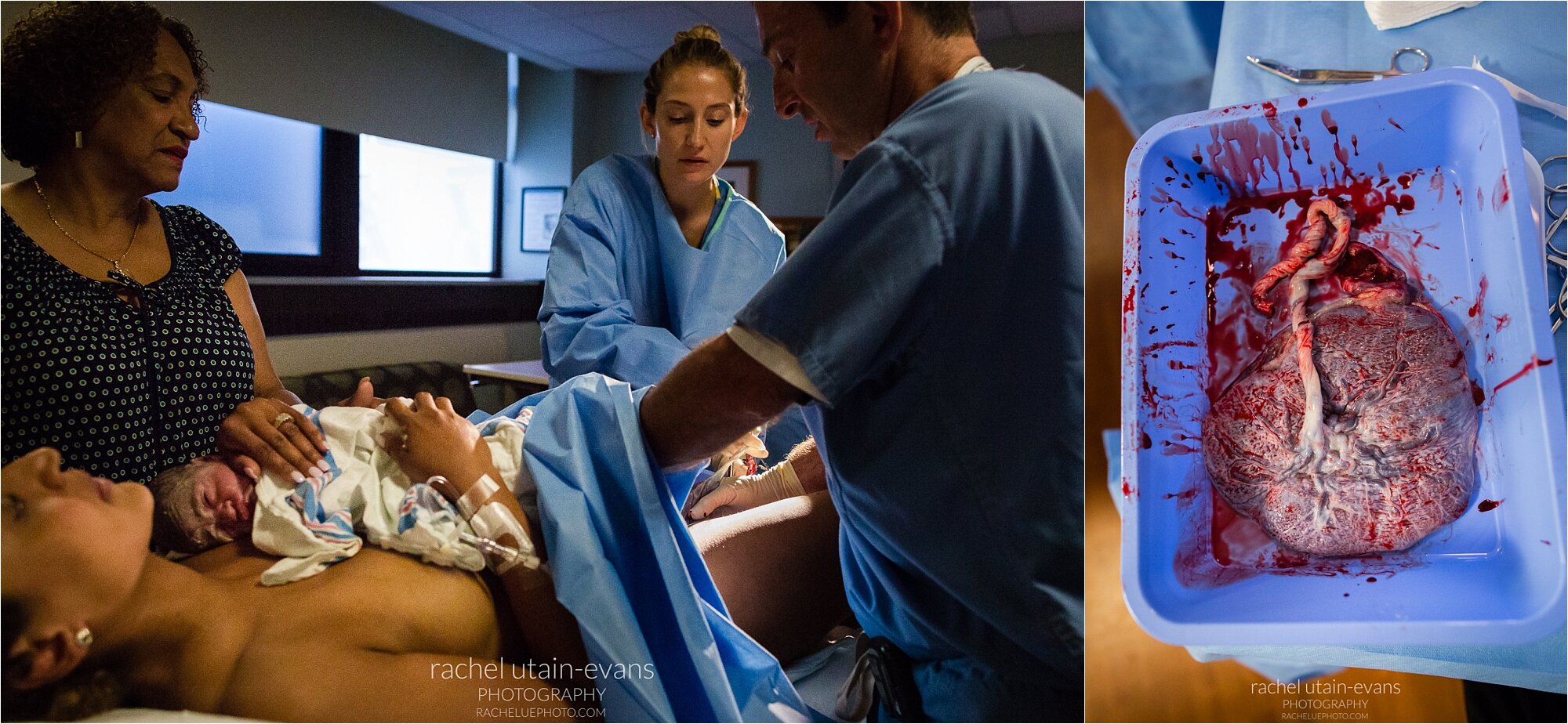 Woman delivers placenta with help of obstetrician and nurse, grandma watches, baby rests skin to skin, placenta in blue basin, Philadelphia Birth Photographer
