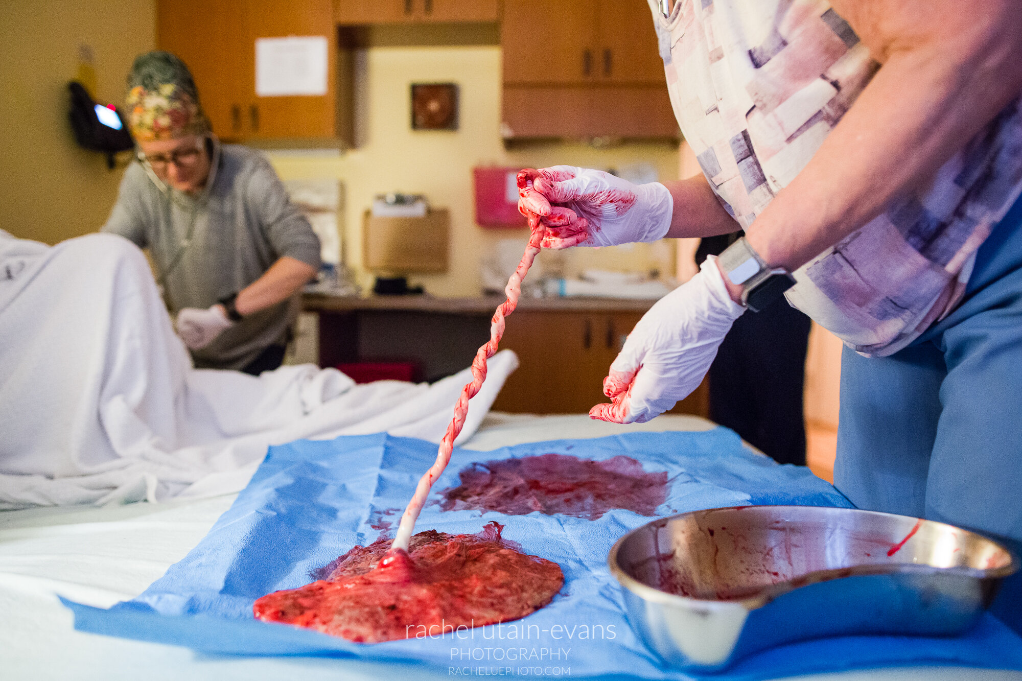 Midwife extends white umbilical cord to show blood has transferred to baby while examining placenta, Philadelphia Birth Photographer
