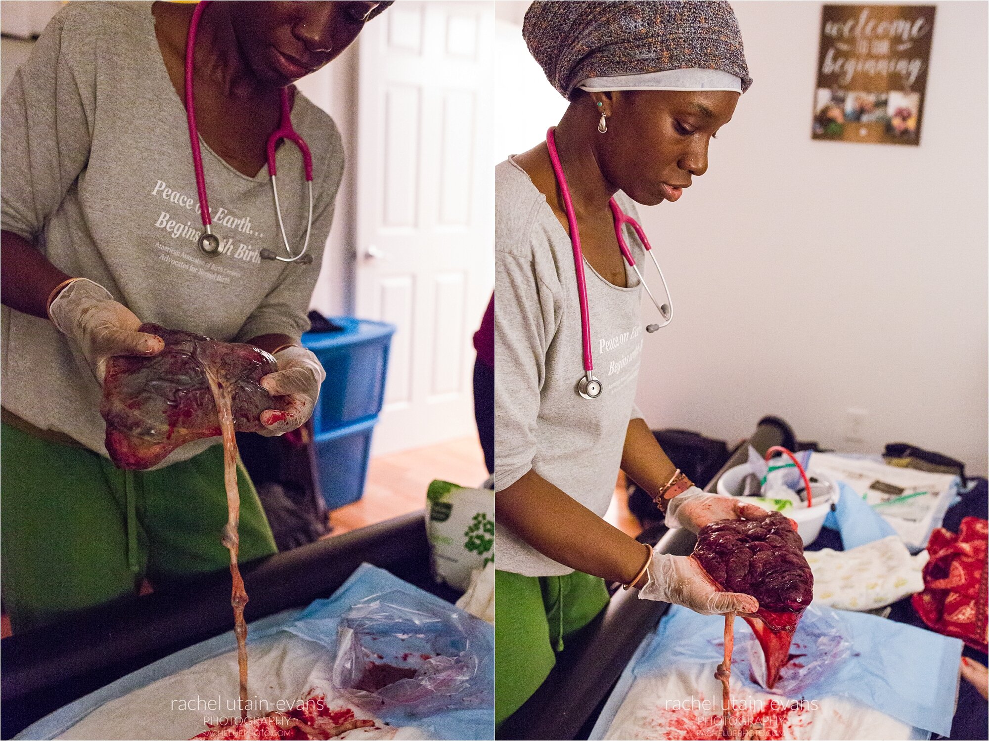 Midwife examines placenta, showing baby's side and mother's side, Philadelphia Birth Photography