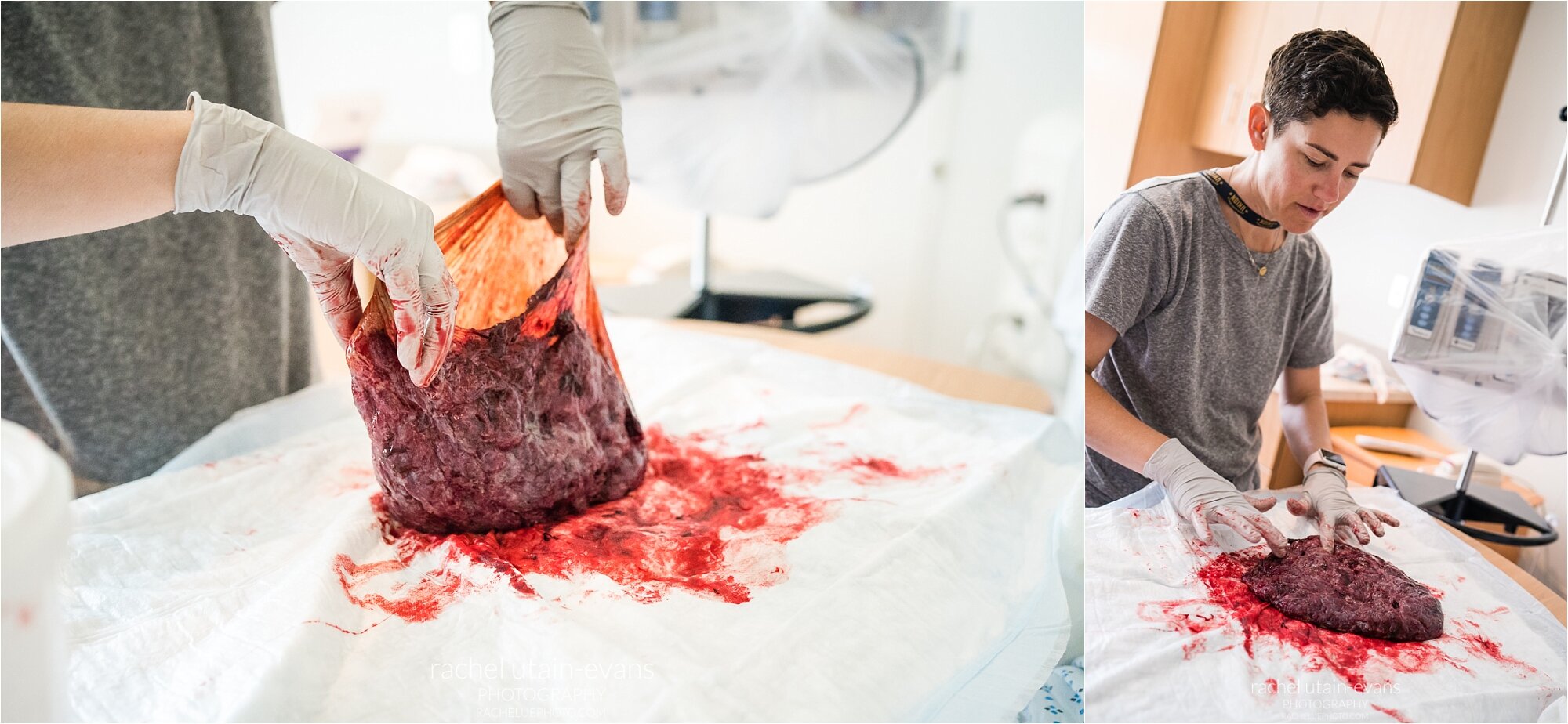 Midwife examines amniotic sac, mother's and baby's sides of the placenta, Philadelphia Birth Photographer