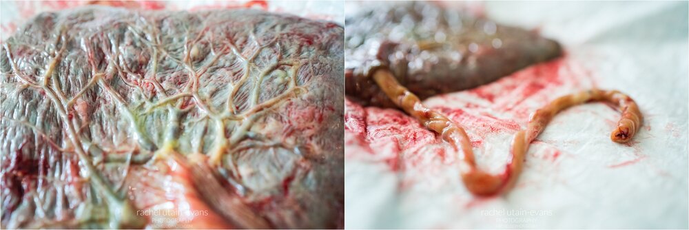 Close detail photo of placenta tinted with meconium, umbilical cord, Philadelphia Birth Photography
