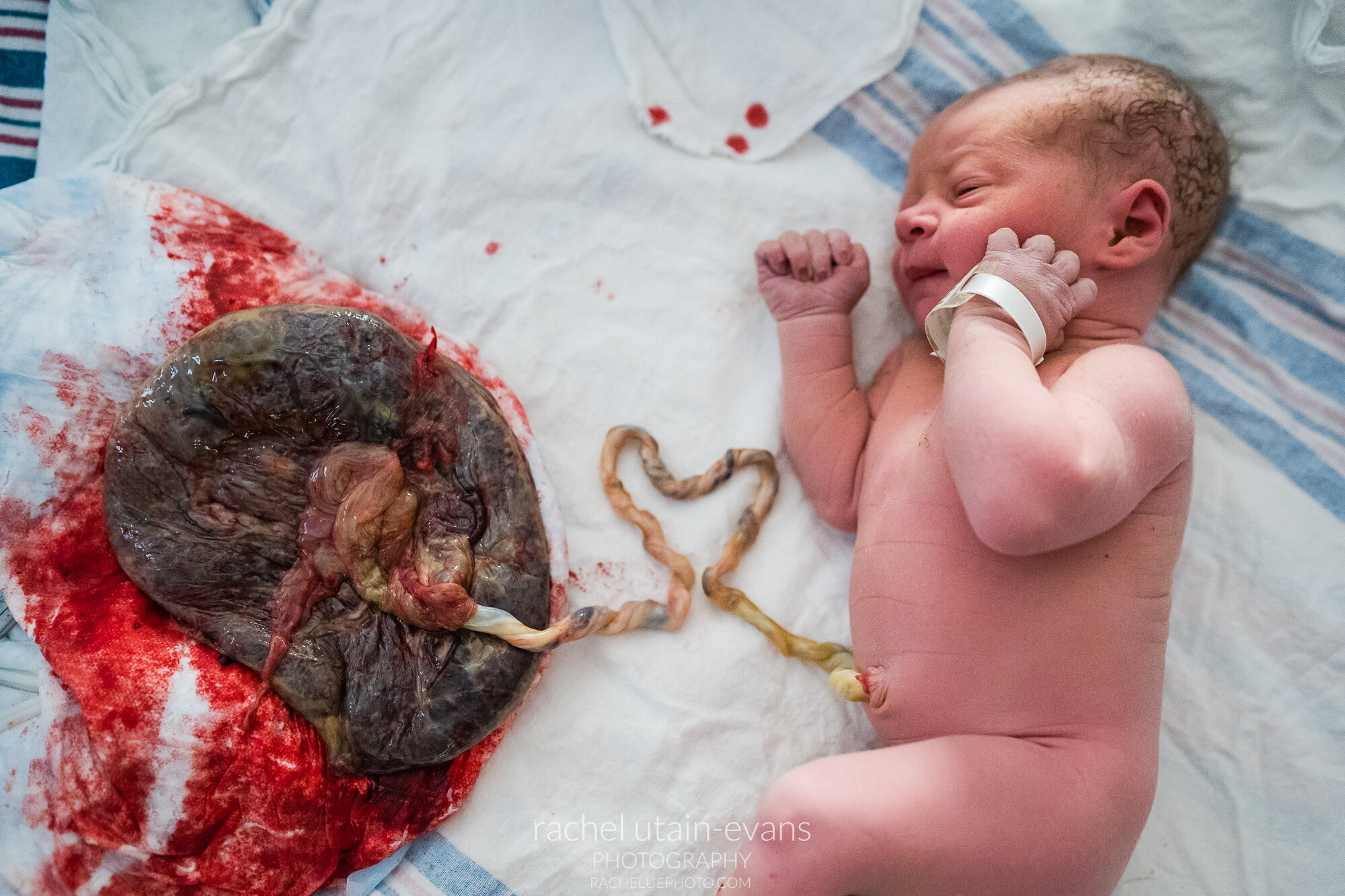 Baby poses next to his placenta with umbilical cord in a heart shape, Philadelphia Birth Photographer