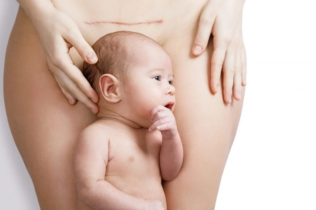 Five tips for your C-section recovery