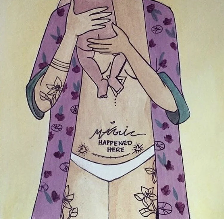 VBAC vs. C-Section: What You Need To Know