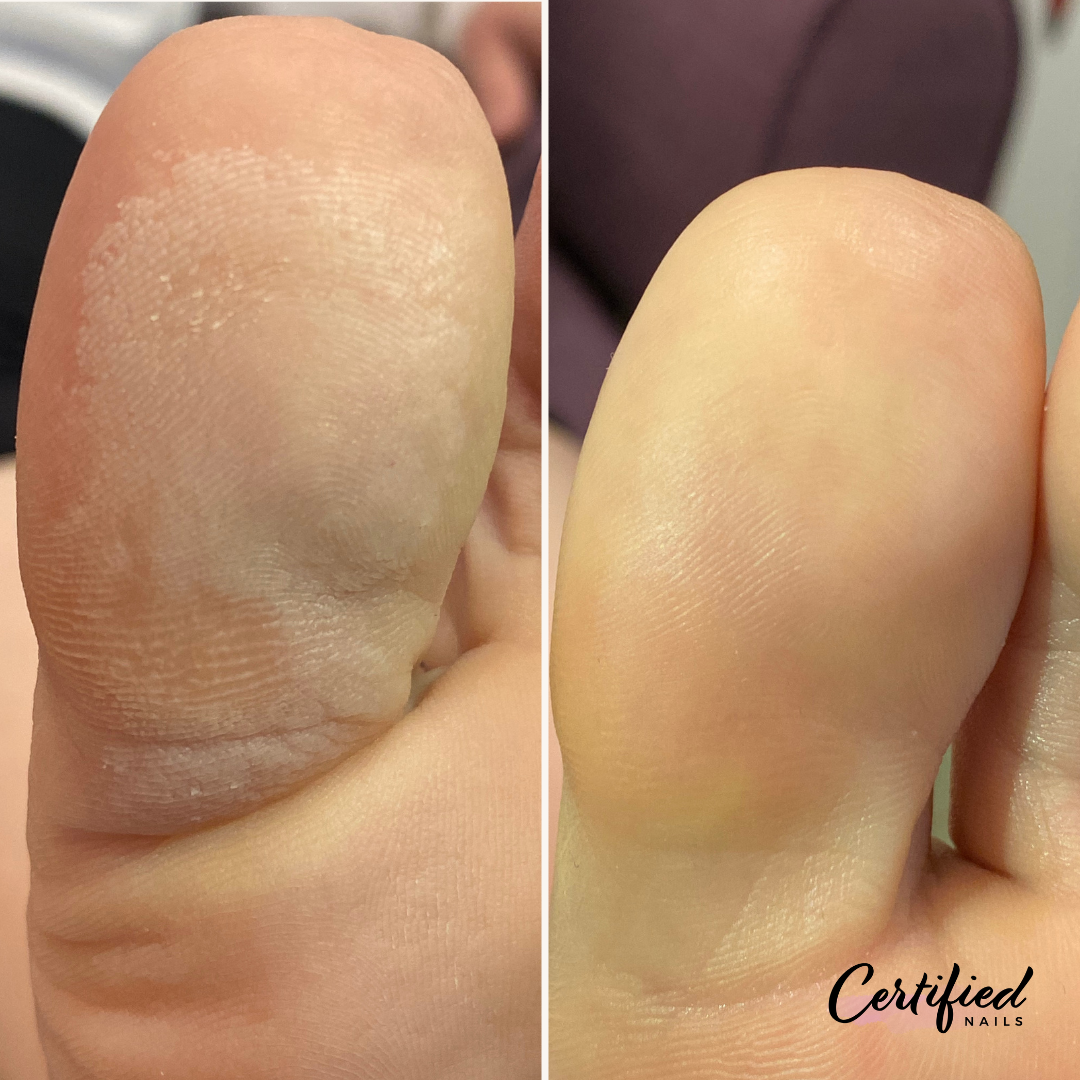 Restorative Pedicure