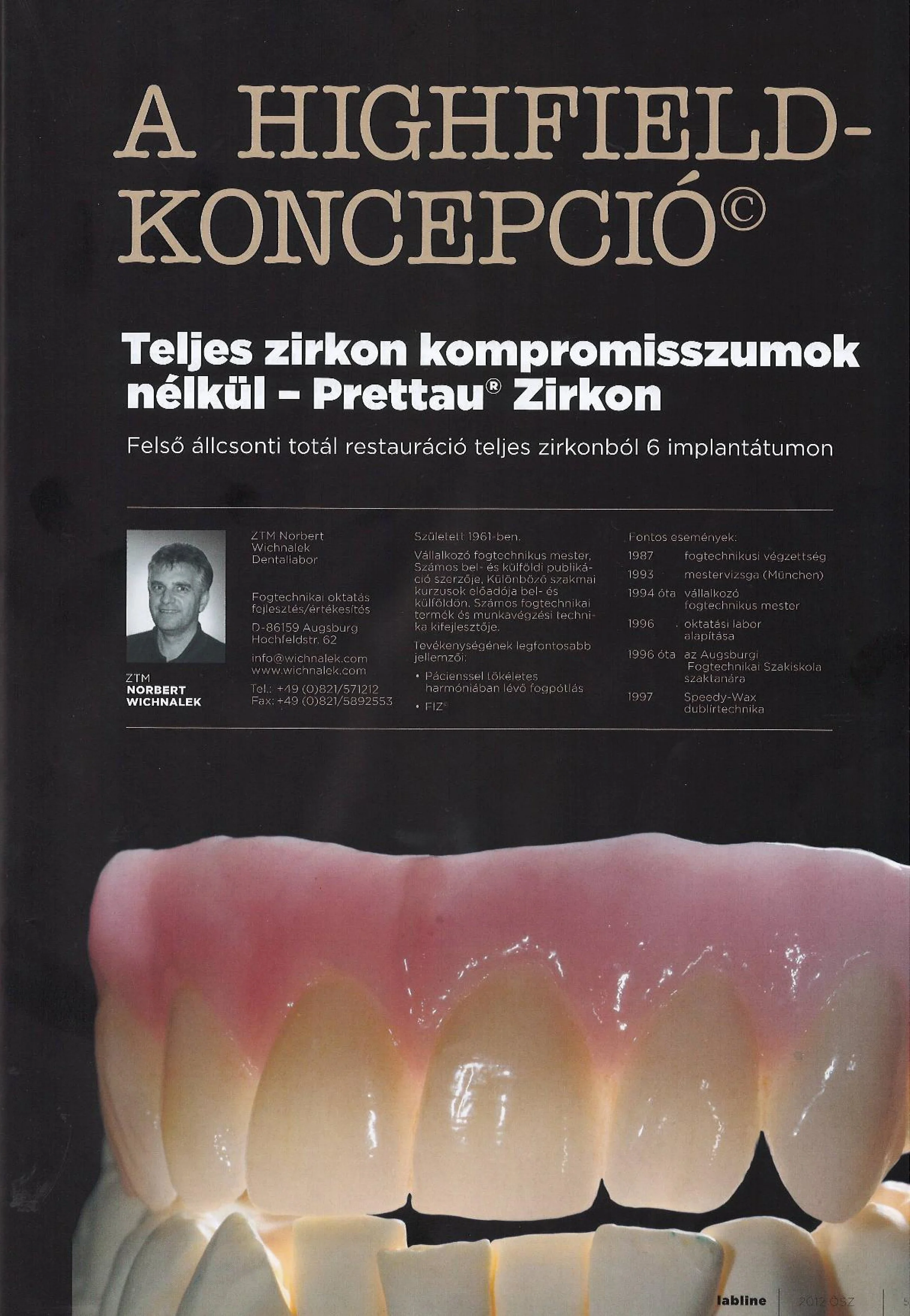 Labline 03/2012 - Teljes zirkon kompromisszumok nélkül - Prettau Zirkon