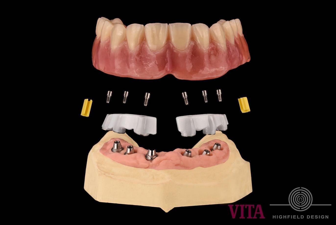News from our Laboratory
HIGHFIELD.DESIGN. #highfielddesign 
... because it should be biocompatible..
VITA YZ&reg; T the Zirconia with the special characteristics.
The layman...would described it as elastic.... it's its good values that make it a spe
