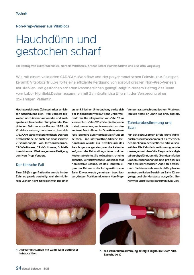 dental dialogue 05/2025 - Hauchdünn und gestochen scharf