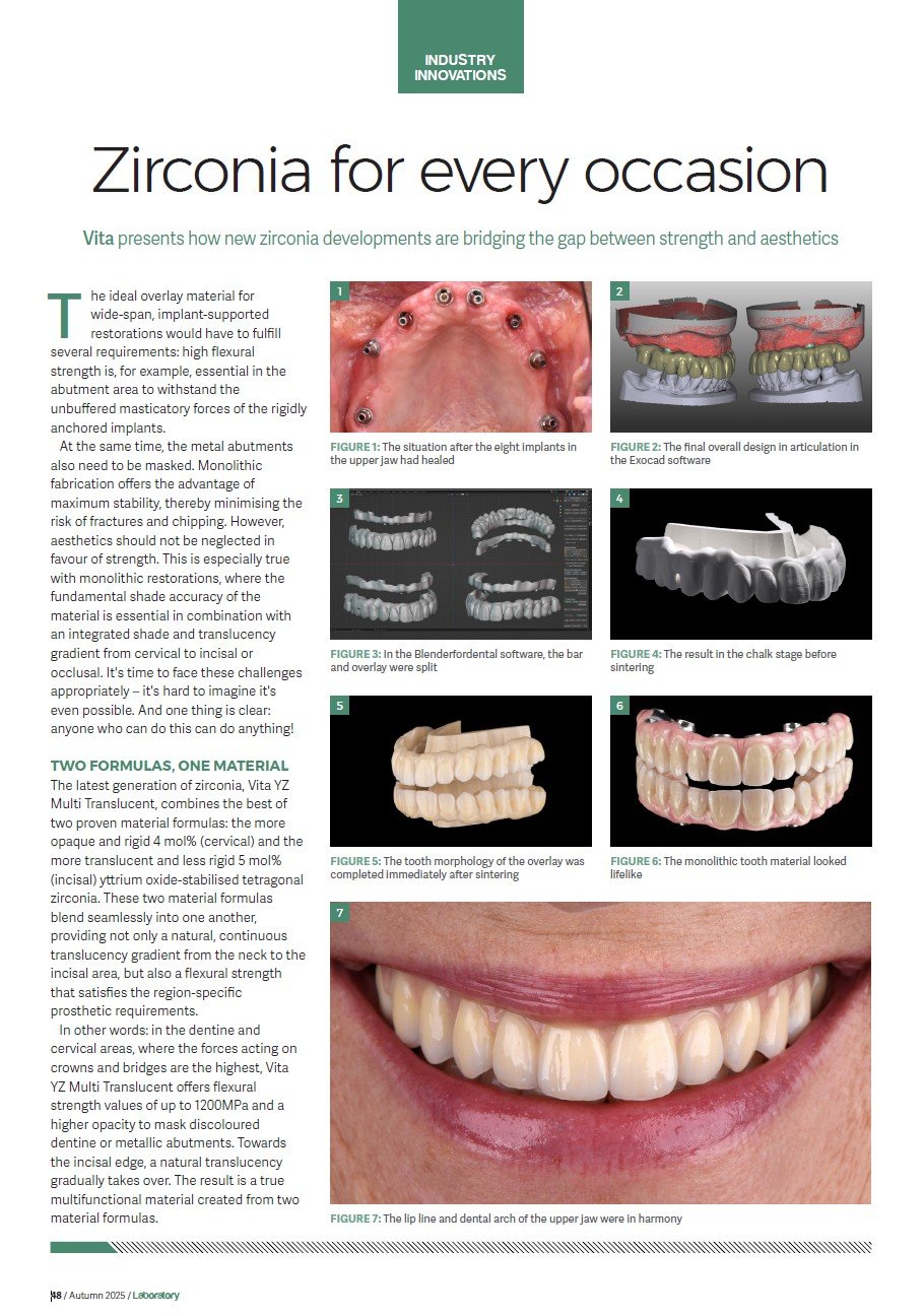 Laboratory UK 11/2025 - Zirconia for every occasion