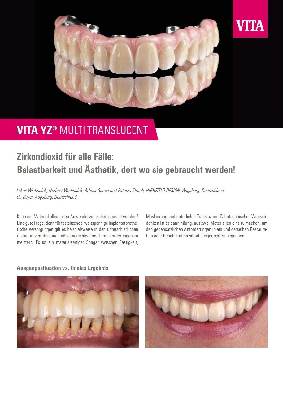 VITA e-paper 2025 - VITA YZ MULTI TRANSLUCENT