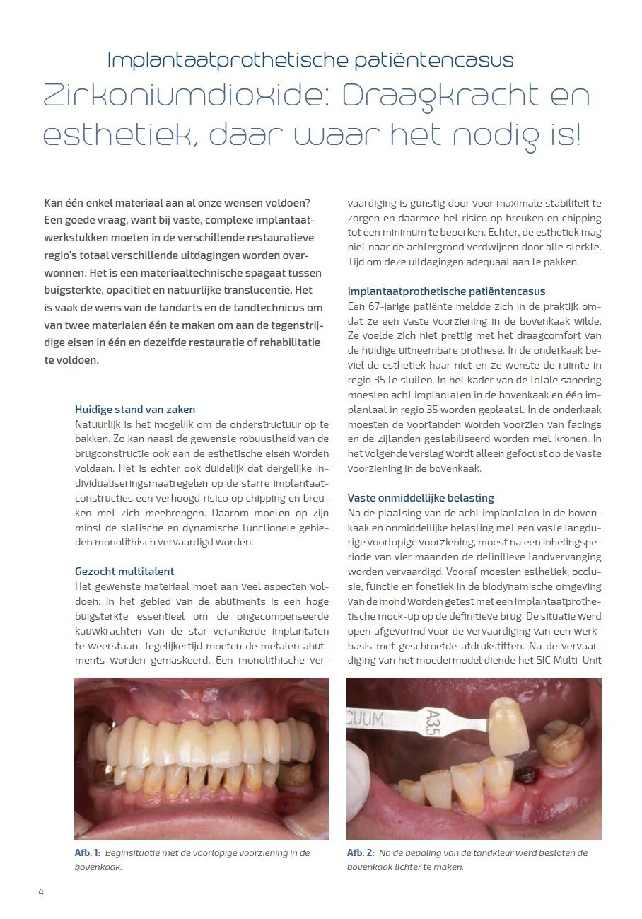 Dentaallab NL 02/2025 - Zirkoniumdioxide: Draagkracht en esthetiek, daar waar het nodig is