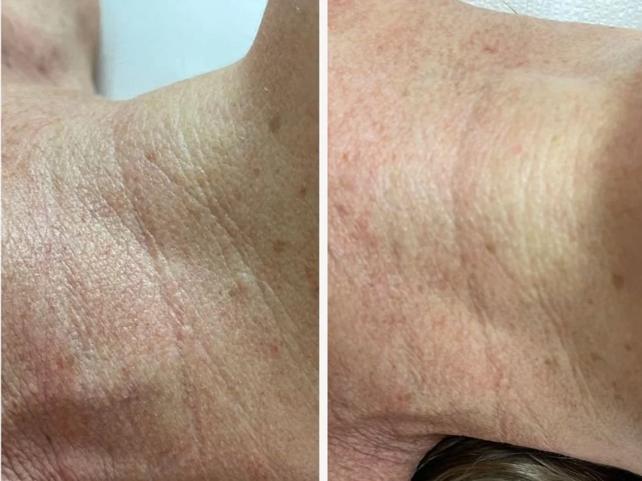 Comparison of skin close-up, showing rough, dry skin on the left and smoother, more hydrated skin on the right.