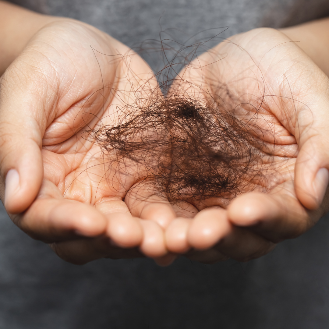 Hair Restoration in Port St Lucie
