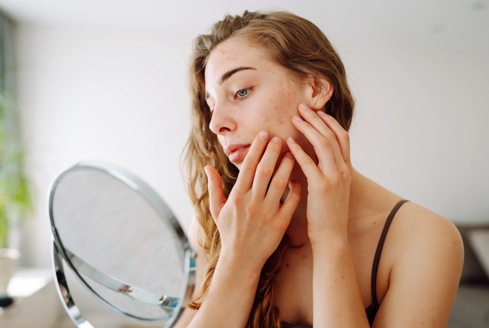 Woman examining her skin in the mirror, showing signs of acne, which can be linked to gut health and skin conditions.