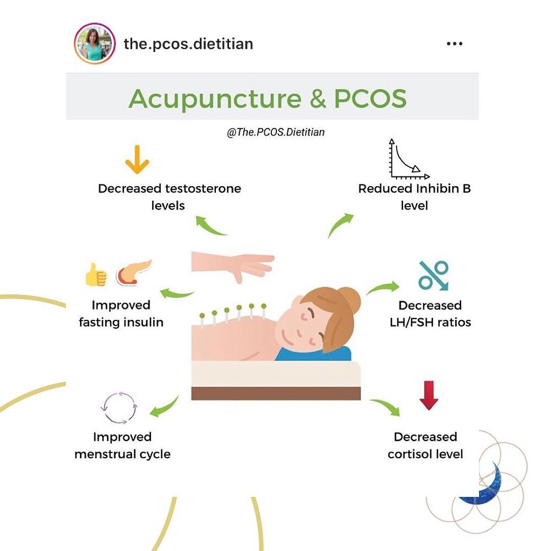 Did you know that acupuncture is really fab at helping with all of the hormone related female problems.

&bull; PCOS can be helped with dietary changes and acupuncture. 

But so can PMS symptoms, painful periods, periods that go missing because we ar