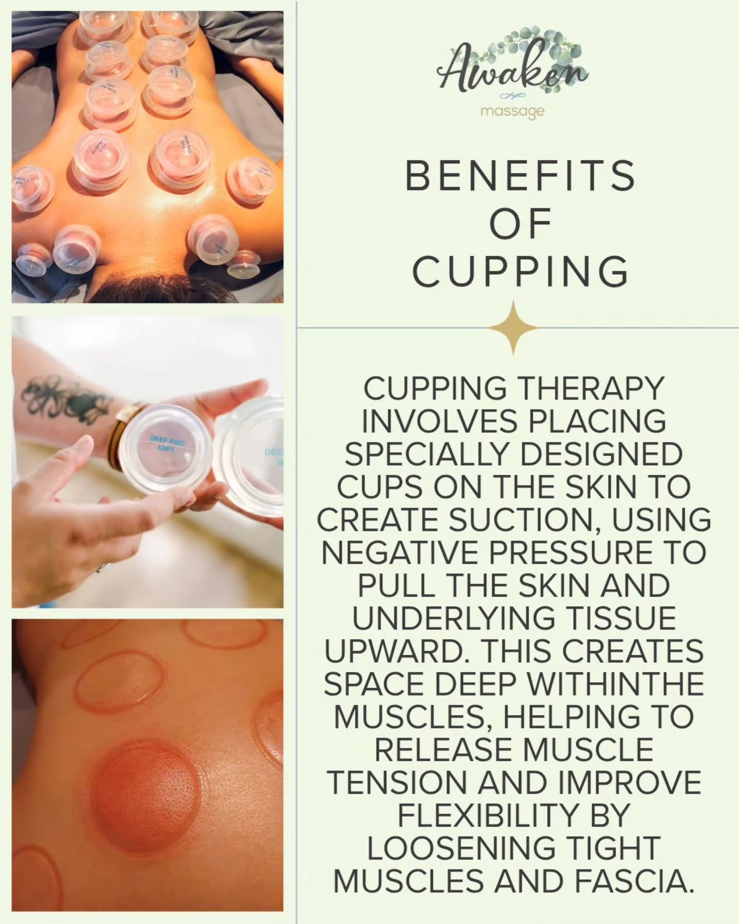 🌿✨ Cupping Therapy! ✨🌿

Discover the transformative benefits of cupping therapy at Awaken Massage! 👐💆&zwj;♀️

Cupping involves placing specially designed cups on the skin to create suction, which helps pull the skin and underlying tissue upward. 