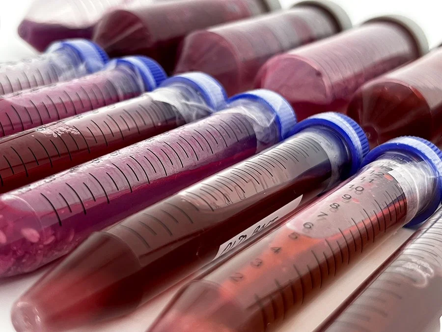 PROFILE — bioMATTERS