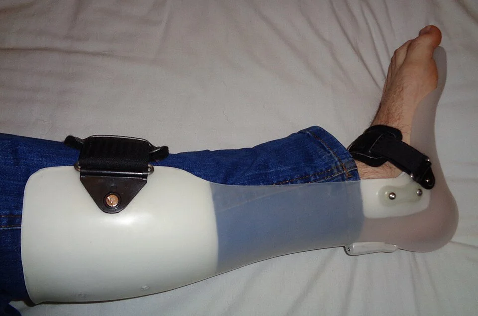 Photo of a lower leg with a plastic ankle-foot orthosis running from the calf to under the foot.