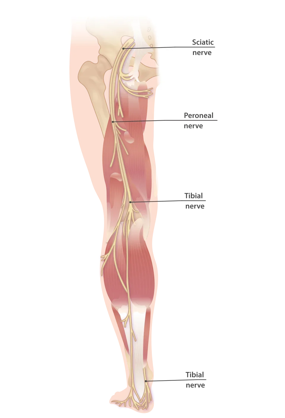 Drawing of the leg from behind showing the sciatic nerve, the peroneal nerve and the tibial nerve.