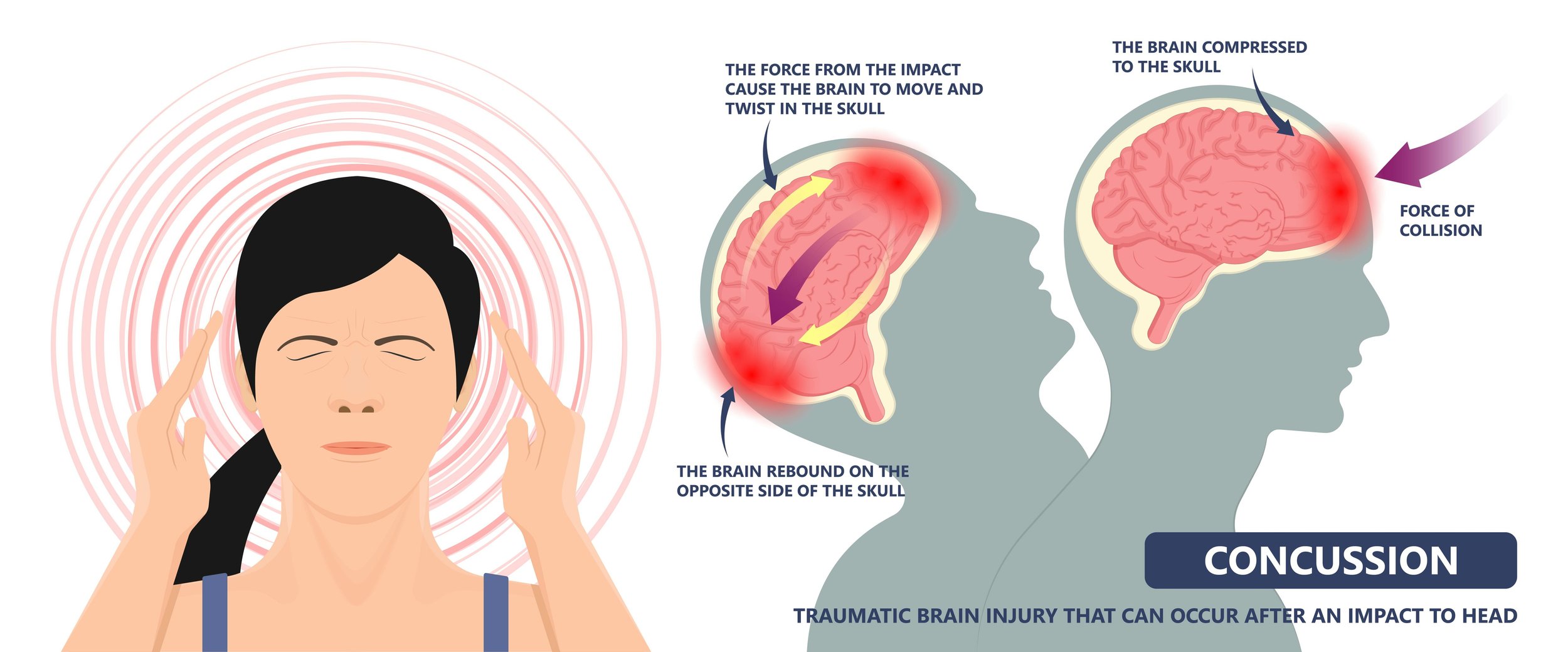 Traumatic Brain Injury