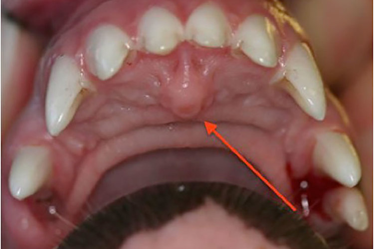 What Is That?! Incisive | Clarendon Care