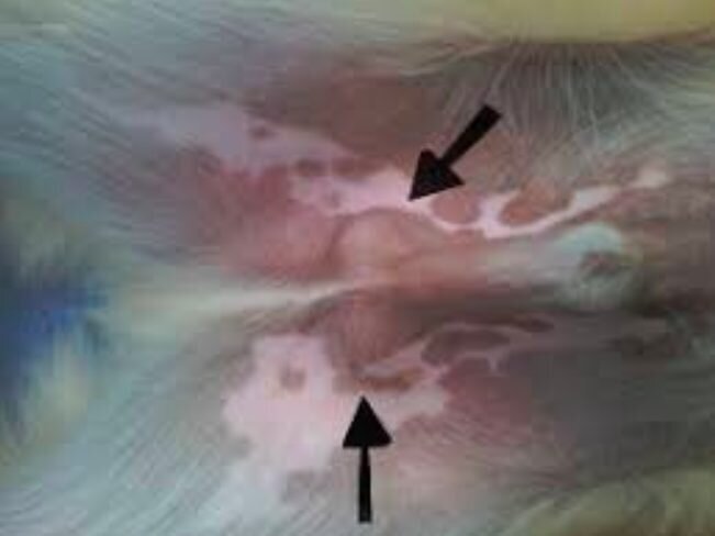 Pink bumps on penile shaft