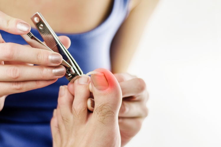 Is there any way I can fix a broken nail without filing or cutting it off?  - Quora