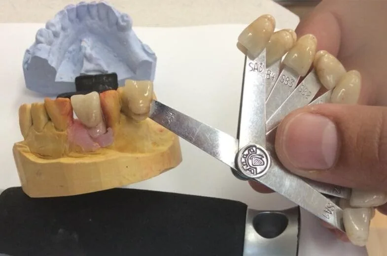 implantat+2.jpg