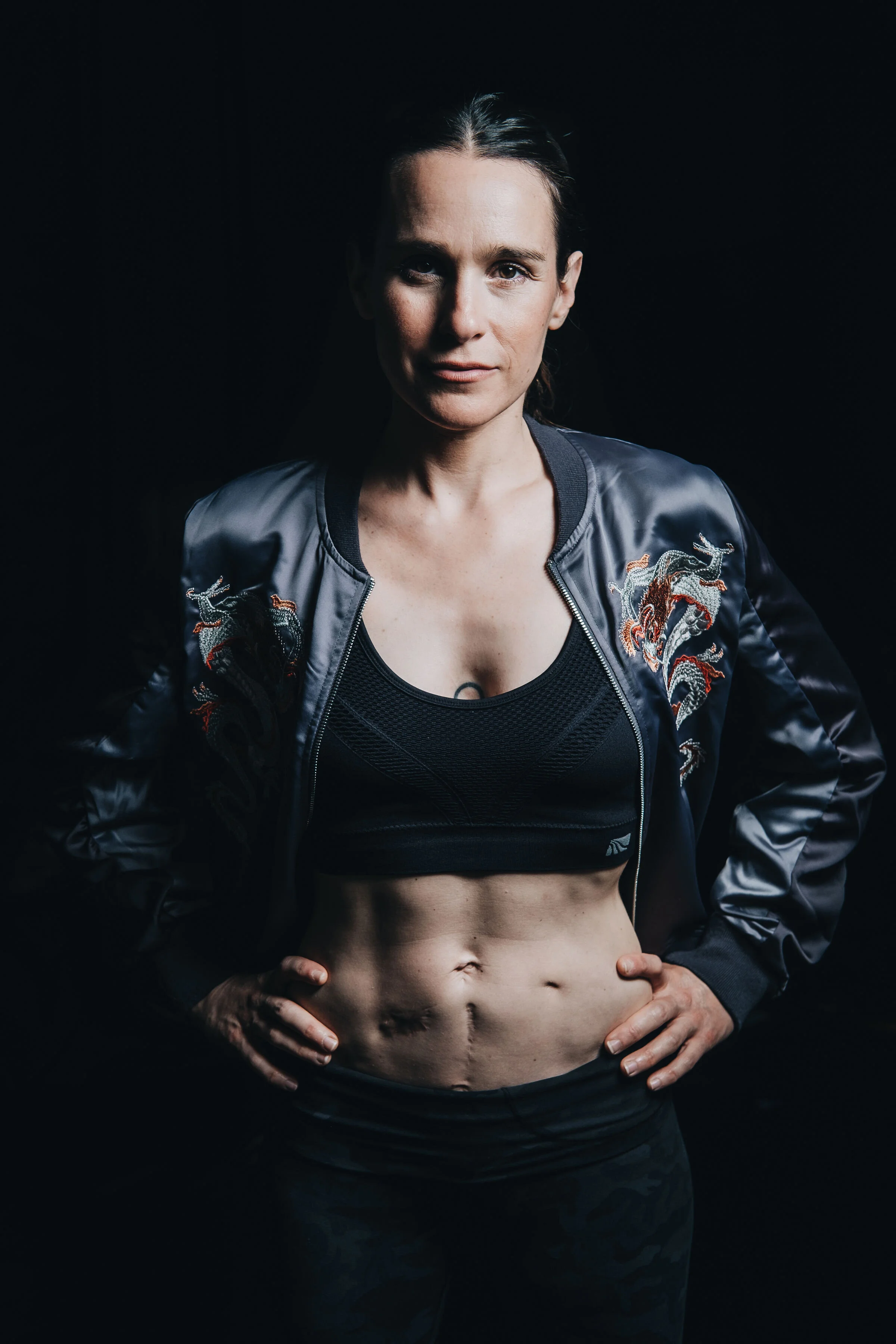 “Are you Jewish?”: My IBD story