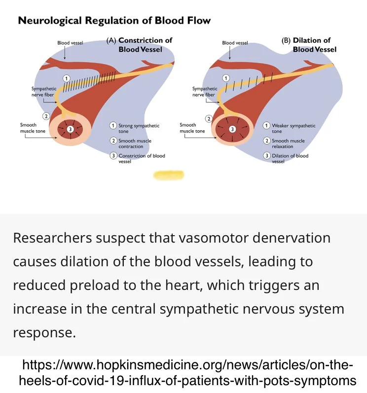Postural Orthostatic Tachycardia Syndrome (POTS) — covidCAREgroup