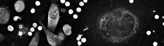 Label-Free Live Cell Analysis using Nanolive's 3D Cell Explorer