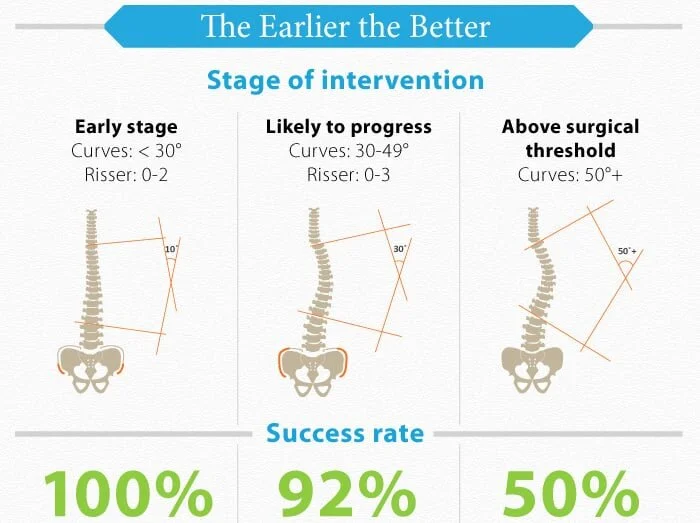 scoliosis-intervention-stages.jpg