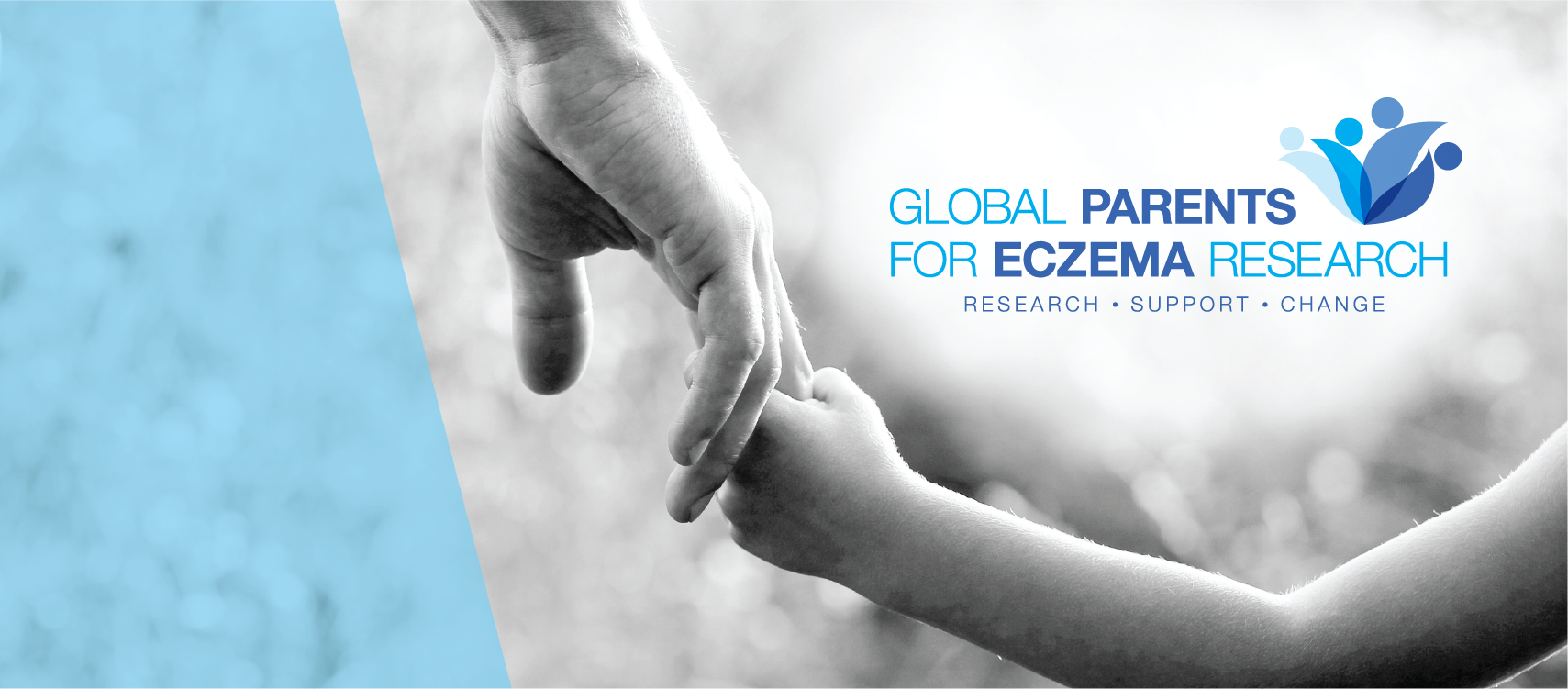 Podcast On Eczema Science And Research Atopic Dermatitis From A Parent Perspective Global Parents For Eczema Research
