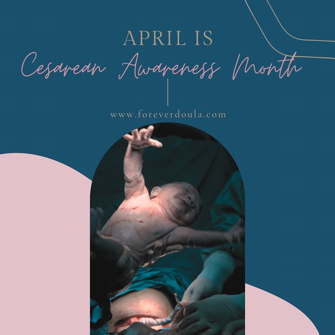 All Birth is Birth. Only a mother could cut her own body open for her child. We love and respect you. #cesarean #csection #birthdoula #nycdoula #njdoula #postpartumcare #birth