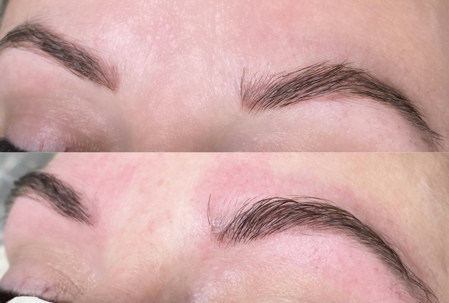 Saline Removal — Permanent Makeup Studio of Virginia