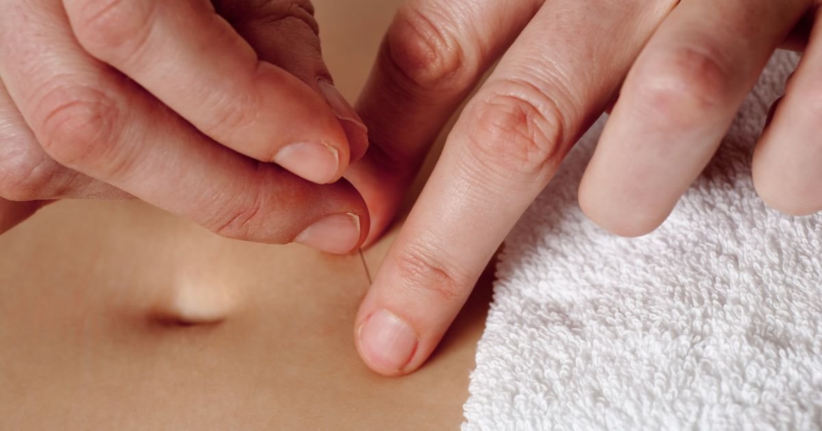 Acupuncture for Hormone Health: What the Research Actually Says