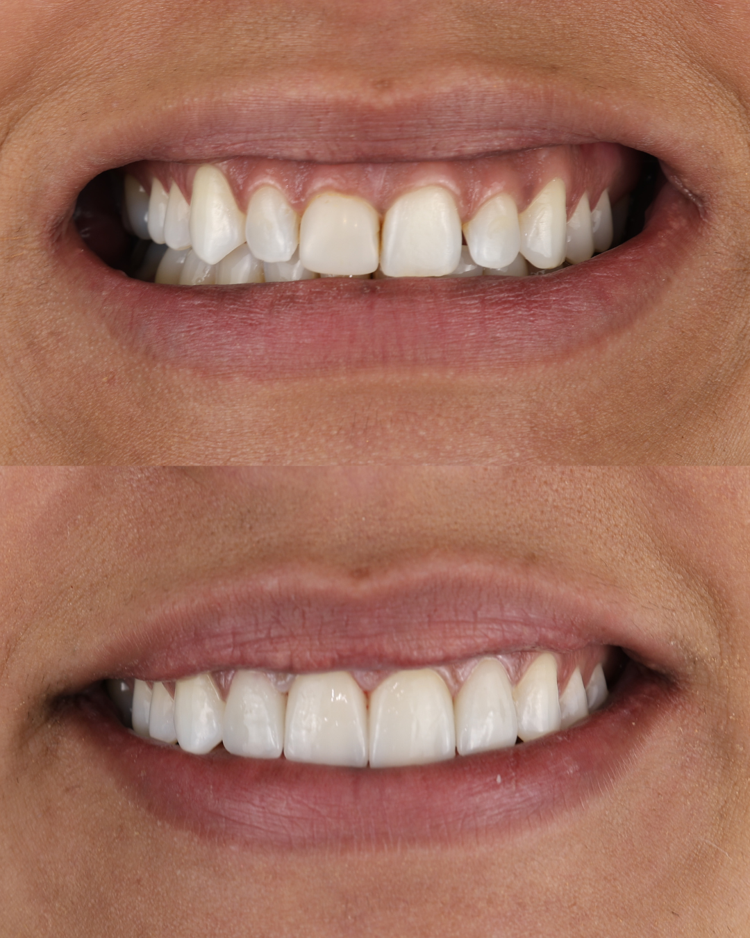 Untitled design (1).png